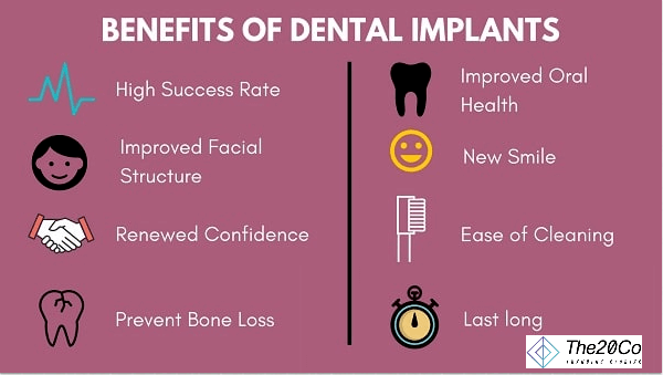 Top Benefits of Dental Implants