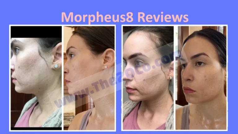 Morpheus8 Reviews {Is Morpheus8 Legit or Scam?}