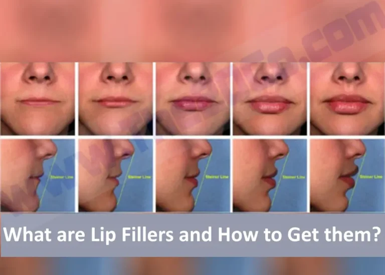 What are Lip Fillers and How to Get them?
