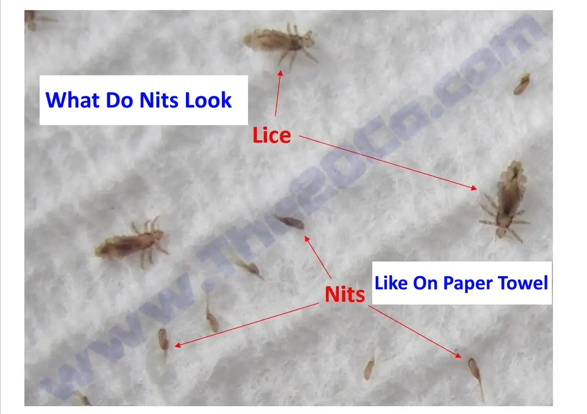What do nits look like on paper towel?