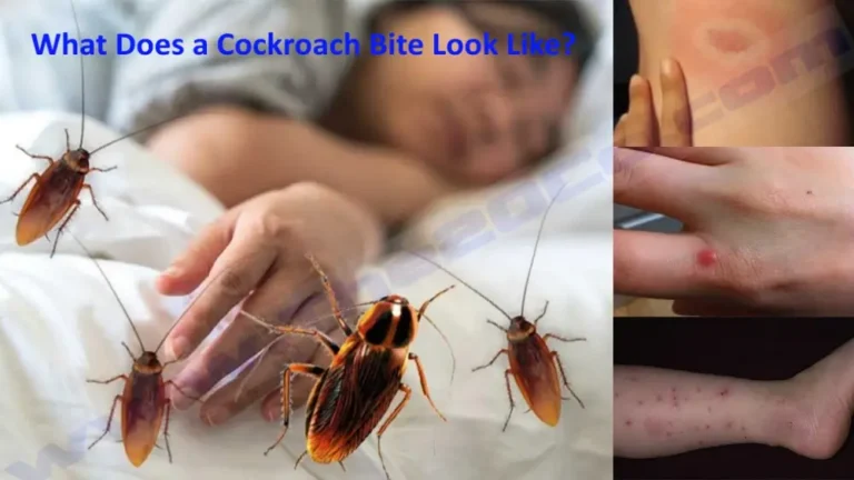 What Does a Cockroach Bite Look Like?