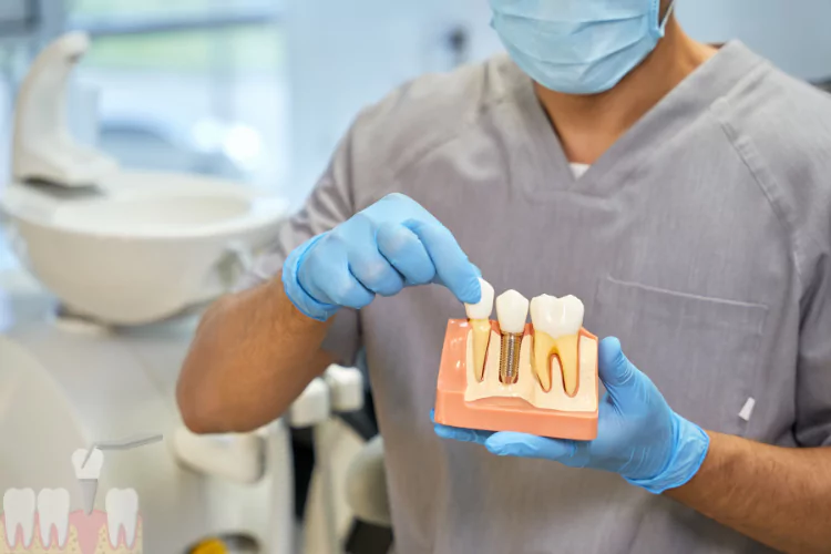 Top Benefits of Dental Implants